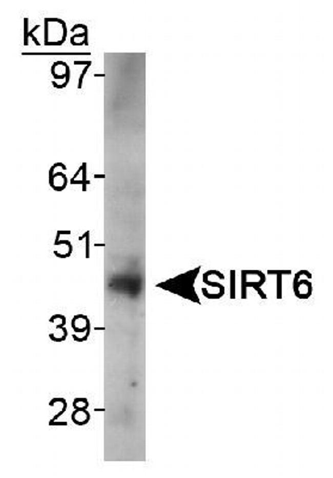 SIRT6 Antibody in Western Blot (WB)