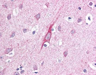 ATP13A2 Antibody in Immunohistochemistry (IHC)