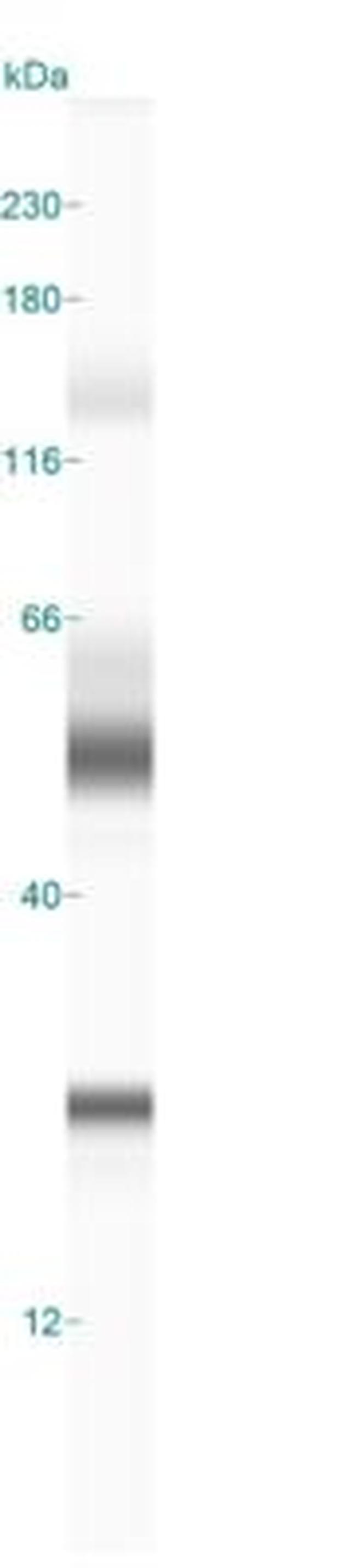 CGI58 Antibody in Western Blot (WB)