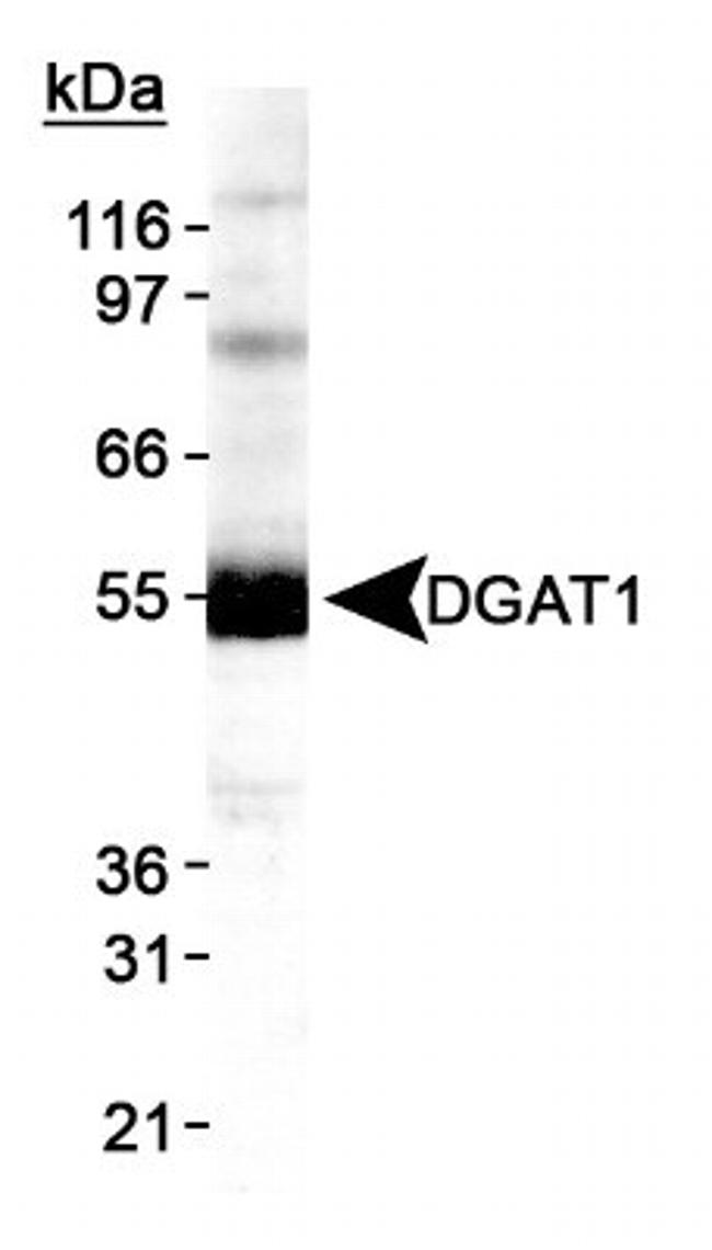 DGAT1 Antibody in Western Blot (WB)