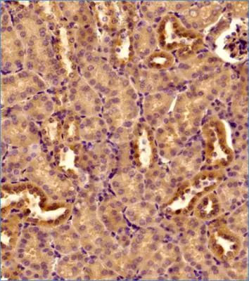 DNM1L Antibody in Immunohistochemistry (Paraffin) (IHC (P))