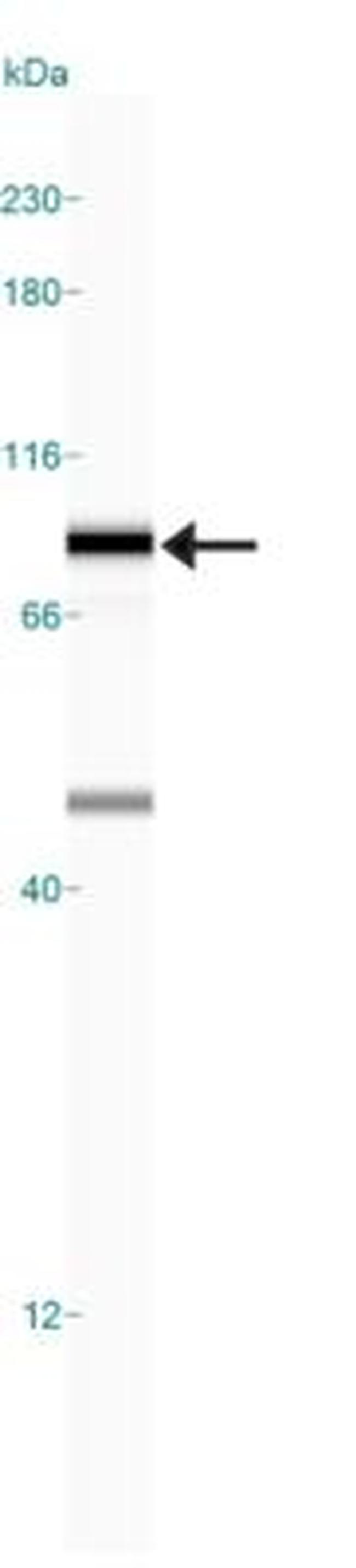 DNM1L Antibody in Western Blot (WB)