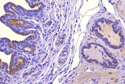 SAT1 Antibody in Immunohistochemistry (Paraffin) (IHC (P))