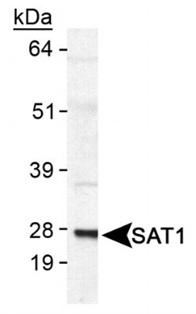 SAT1 Antibody in Western Blot (WB)