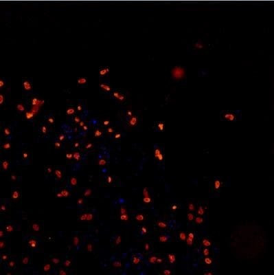 TDP-43 Antibody in Immunocytochemistry (ICC/IF)