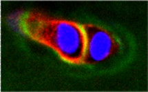 ADAMTS5 Antibody in Immunocytochemistry (ICC/IF)