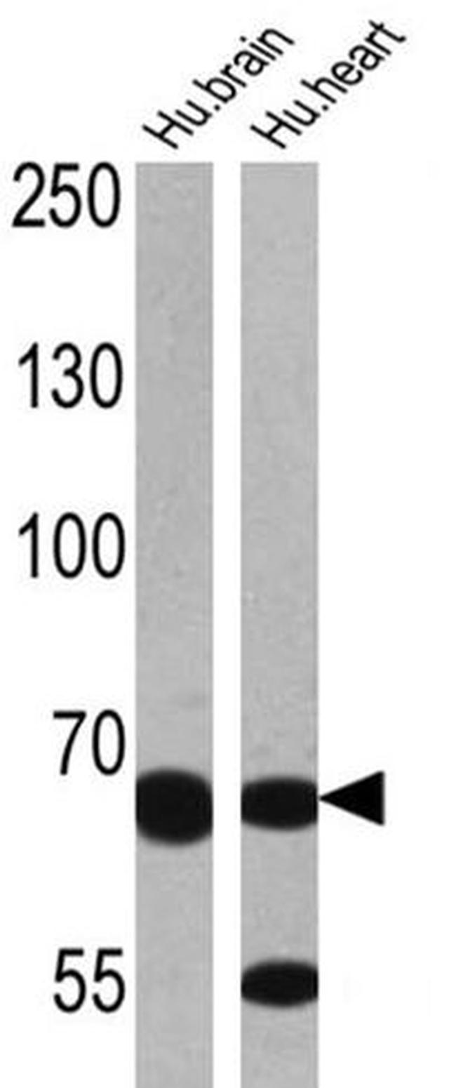 ADAMTS5 Antibody in Western Blot (WB)