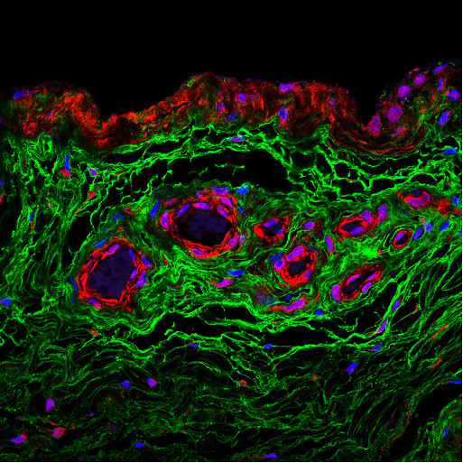 ITIH1 Antibody in Immunohistochemistry (Paraffin) (IHC (P))