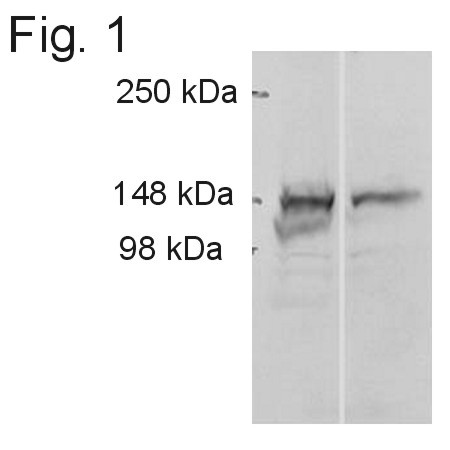 ADAMTS9 Antibody in Western Blot (WB)