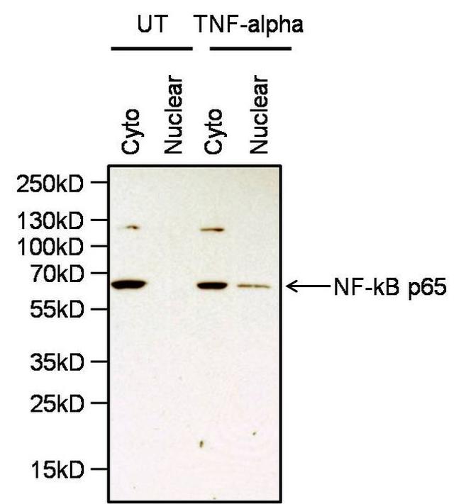 NFkB p65 Antibody