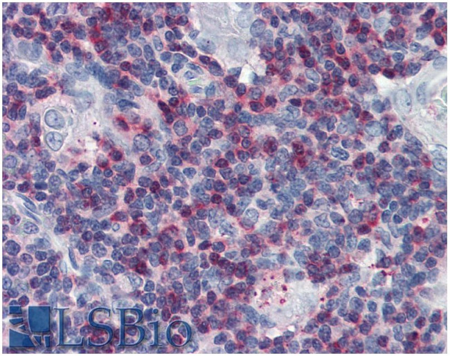 SLP76 Antibody in Immunohistochemistry (Paraffin) (IHC (P))