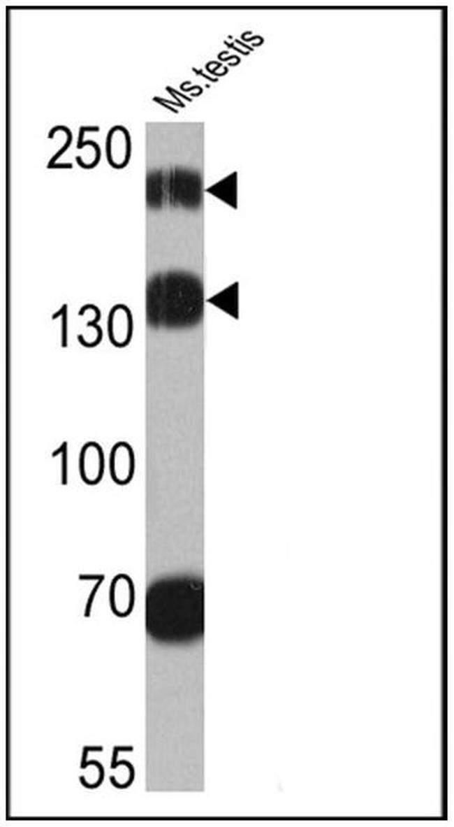 PSME4 Antibody in Western Blot (WB)