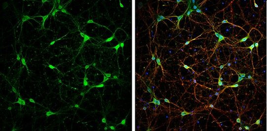 PGP9.5 Antibody in Immunocytochemistry (ICC/IF)