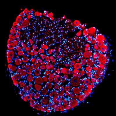 PGP9.5 Antibody in Immunohistochemistry (IHC)