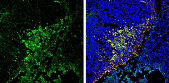 PGP9.5 Antibody in Immunohistochemistry (Frozen) (IHC (F))