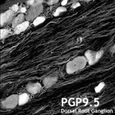 PGP9.5 Antibody in Immunohistochemistry (Frozen) (IHC (F))