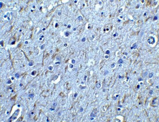 GFR alpha-1 Antibody in Immunohistochemistry (Paraffin) (IHC (P))