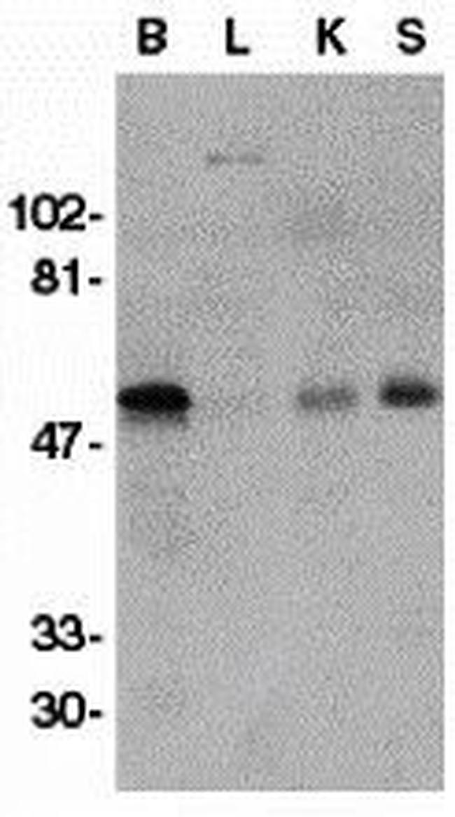 GFR alpha-1 Antibody in Western Blot (WB)