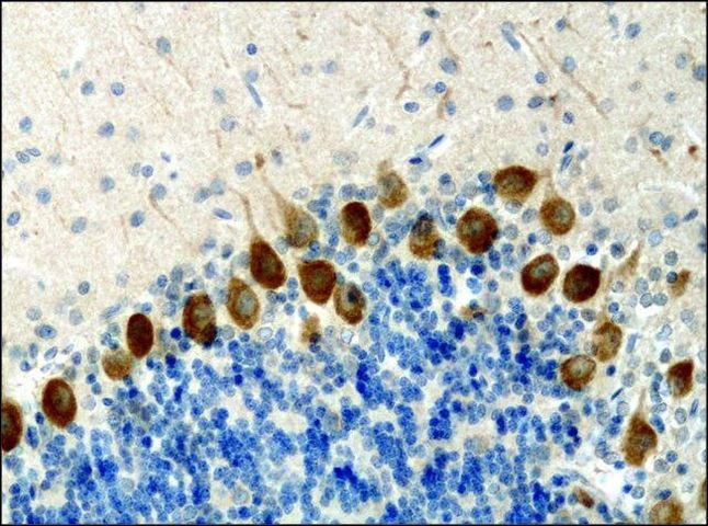 KIF3A Antibody in Immunohistochemistry (Paraffin) (IHC (P))