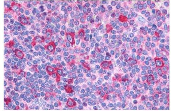 GPR132 Antibody in Immunohistochemistry (Paraffin) (IHC (P))