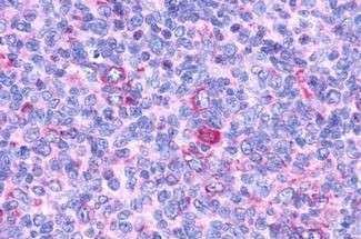 GPR132 Antibody in Immunohistochemistry (Paraffin) (IHC (P))