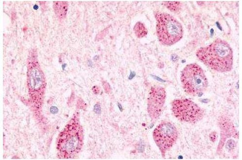 GPR26 Antibody in Immunohistochemistry (Paraffin) (IHC (P))