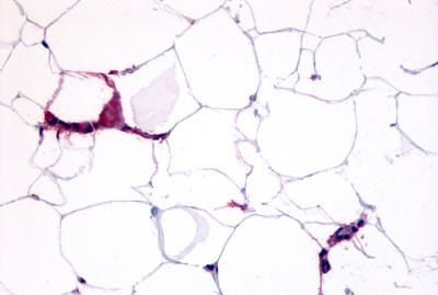 GPR109B Antibody in Immunohistochemistry (Paraffin) (IHC (P))