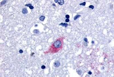 LGR4 Antibody in Immunohistochemistry (Paraffin) (IHC (P))