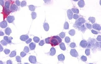 GPR35 Antibody in Immunocytochemistry (ICC/IF)