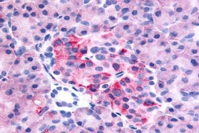 GPR35 Antibody in Immunohistochemistry (Paraffin) (IHC (P))