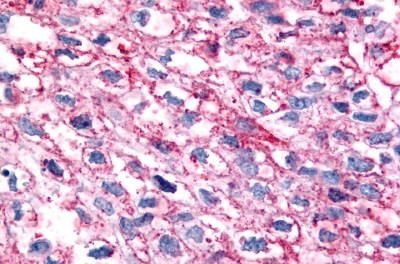 GPR35 Antibody in Immunohistochemistry (Paraffin) (IHC (P))