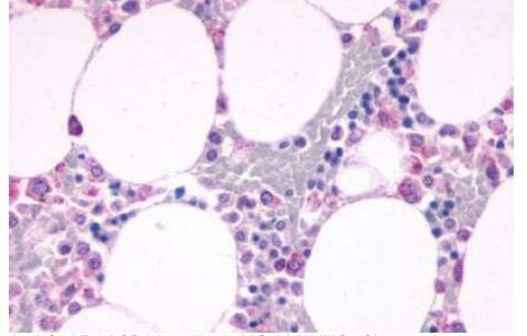 C5AR1 Antibody in Immunohistochemistry (Paraffin) (IHC (P))