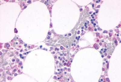 C5AR1 Antibody in Immunohistochemistry (Paraffin) (IHC (P))