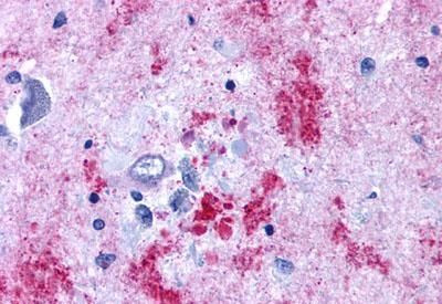 Endothelin B Receptor Antibody in Immunohistochemistry (Paraffin) (IHC (P))