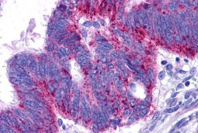 Endothelin B Receptor Antibody in Immunohistochemistry (Paraffin) (IHC (P))