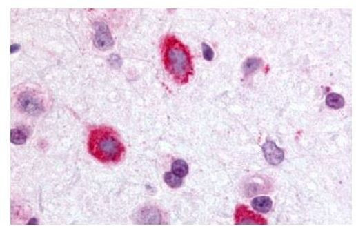 GALR3 Antibody in Immunohistochemistry (Paraffin) (IHC (P))