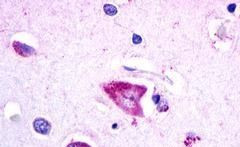 GALR3 Antibody in Immunohistochemistry (Paraffin) (IHC (P))