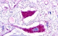 GALR3 Antibody in Immunohistochemistry (Paraffin) (IHC (P))