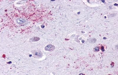 MAS1 Antibody in Immunohistochemistry (Paraffin) (IHC (P))