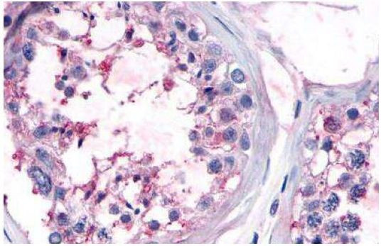 OR10R2 Antibody in Immunohistochemistry (Paraffin) (IHC (P))