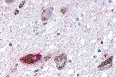 OR10R2 Antibody in Immunohistochemistry (Paraffin) (IHC (P))