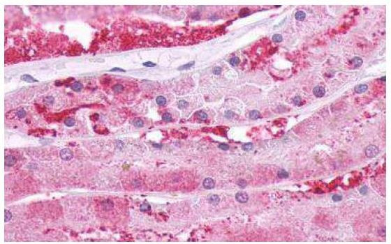 PTH1R Antibody in Immunohistochemistry (Paraffin) (IHC (P))