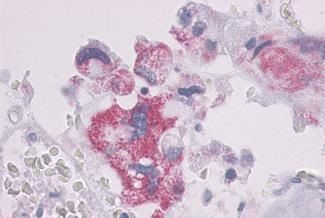 PTH1R Antibody in Immunohistochemistry (Paraffin) (IHC (P))