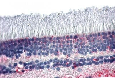 PNR Antibody in Immunohistochemistry (Paraffin) (IHC (P))