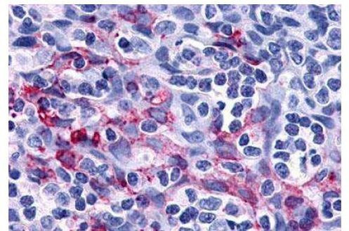 P2Y11 Antibody in Immunocytochemistry (ICC/IF)