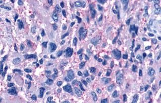 P2Y11 Antibody in Immunohistochemistry (Paraffin) (IHC (P))