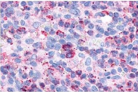 P2Y6 Antibody in Immunohistochemistry (Paraffin) (IHC (P))