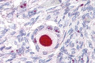 NR5A1 Antibody in Immunohistochemistry (Paraffin) (IHC (P))