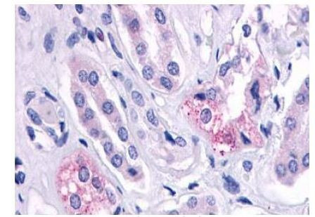 AVPR2 Antibody in Immunohistochemistry (Paraffin) (IHC (P))