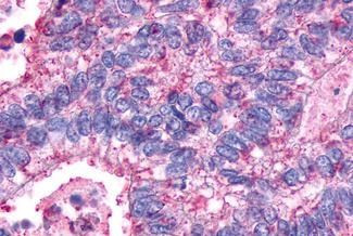 AVPR2 Antibody in Immunohistochemistry (Paraffin) (IHC (P))